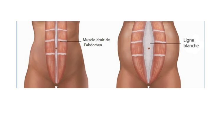 6. muscles abdominaux