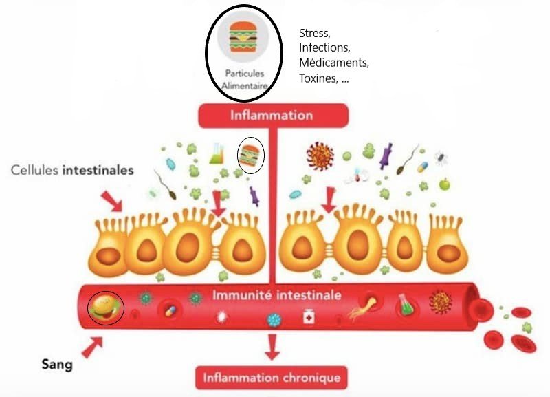 alimentation de la tendinite : Hyperpermabilité intestinale